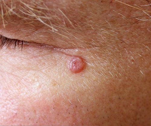 skin-care-gallery-image-6