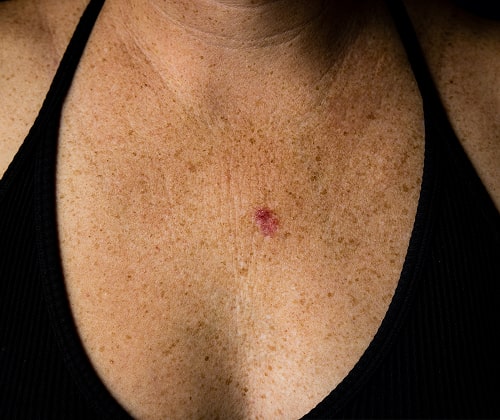 skin-care-gallery-image