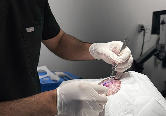 Preparation of Tissue